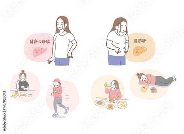 Obraz 健康な肝臓と脂肪肝の女性のイラストセット
