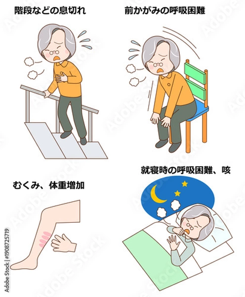 Obraz 心不全の状態