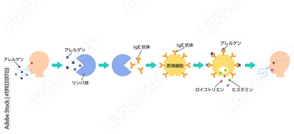 Obraz アレルギー発症のしくみ　花粉症のメカニズム