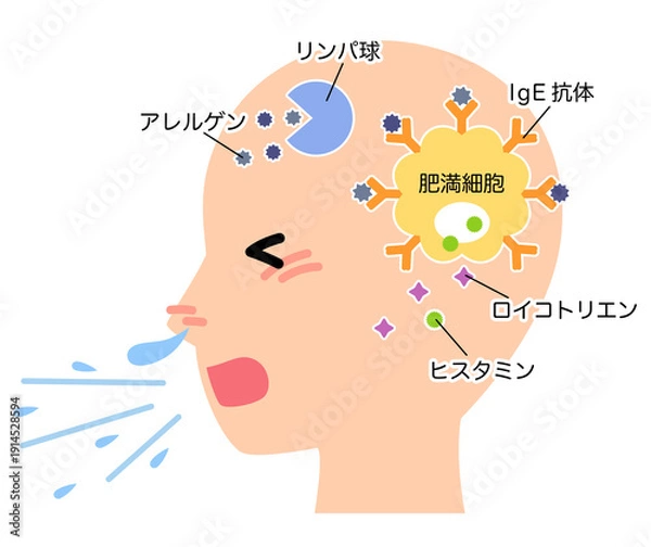 Obraz アレルギー発症のしくみ　花粉症のメカニズム