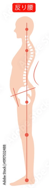 Obraz 反り腰の女性　背骨と骨盤