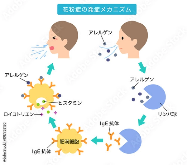 Obraz アレルギー発症のしくみ　花粉症のメカニズム