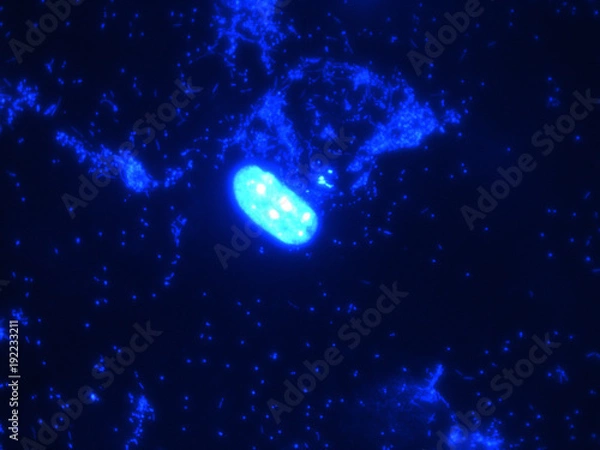 Obraz Blue fibroblast cells with bacteria contamination