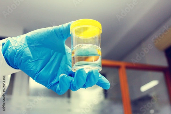 Obraz Urine sample