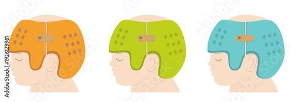 Obraz 頭の形を治すためにヘルメットを被るアジア人の赤ちゃんのイラスト