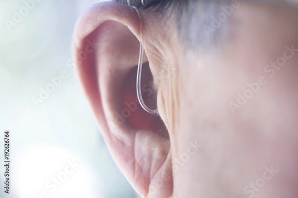 Obraz Hearing aid in ear