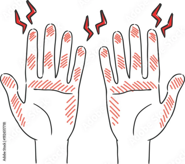 Obraz ハンドケア　手荒れ　トラブルのある手　ベクター