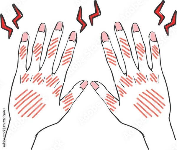 Obraz ハンドケア　手荒れ　トラブルのある手　ベクター