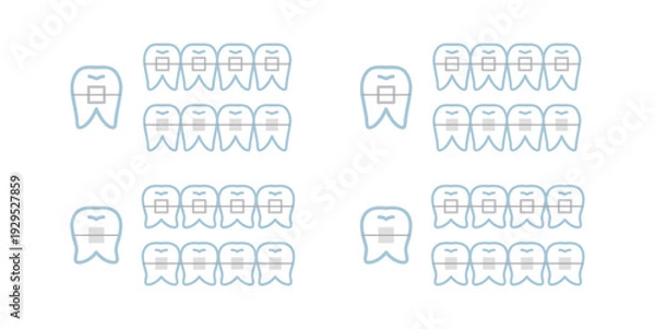 Obraz シンプルな矯正中の歯のイラスト
