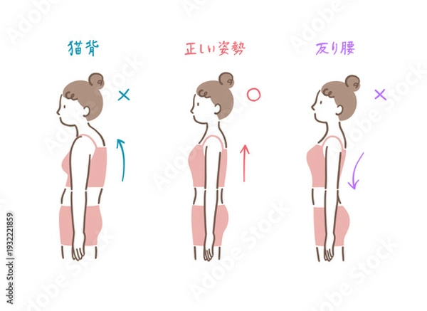 Obraz 横から見た正しい姿勢と猫背と反り腰の女性の比較イラストセット