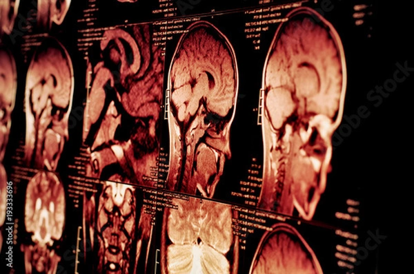 Obraz Blurred background. Magnetic resonance imaging. Concept medical examination.