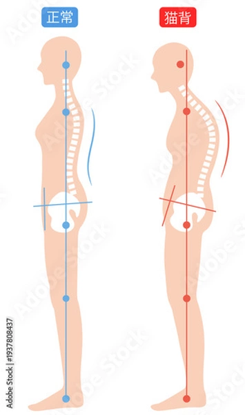 Obraz 猫背と正しい姿勢　背骨と骨盤