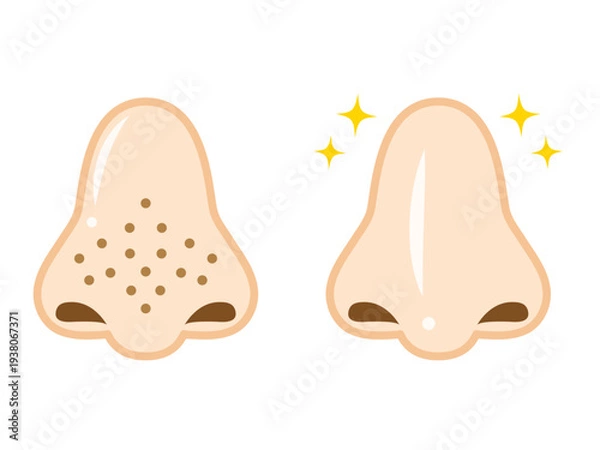 Obraz 毛穴汚れが目立つ鼻のイラスト素材