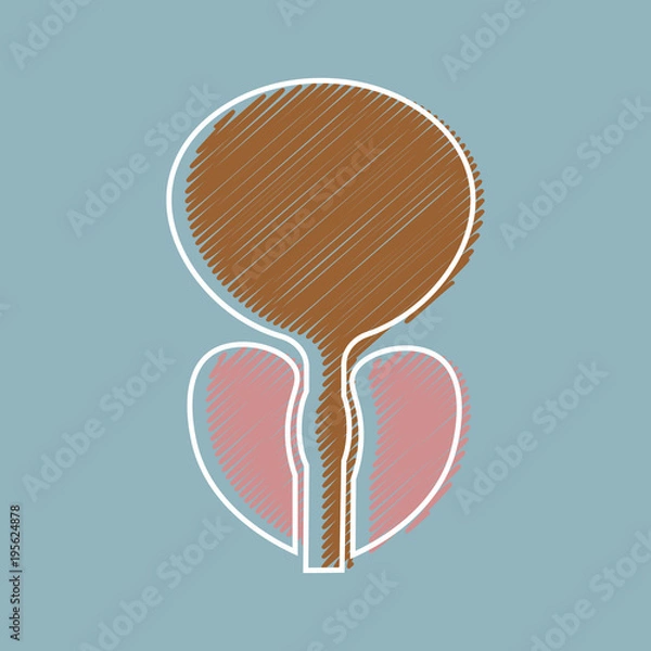 Fototapeta vector illustration of prostatitis. sexual infections, prostate. Styling hatching