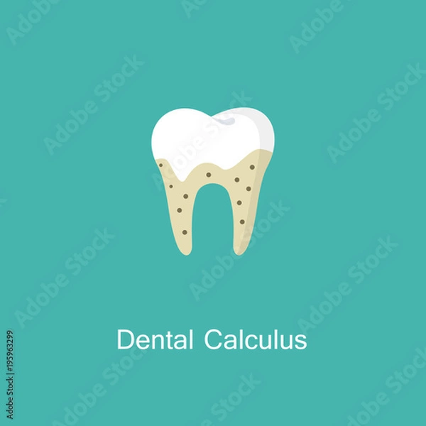 Obraz Tartar or calculus teeth illustration vector icon.