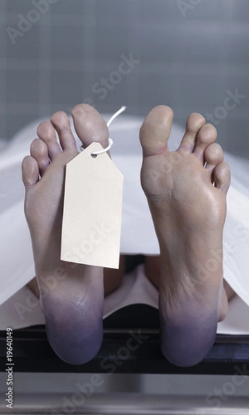 Obraz Leichenfuss Autopsie