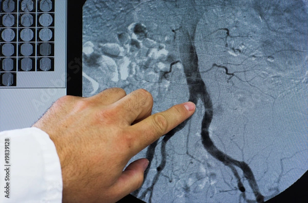 Obraz Reprezentacja naczyniowa