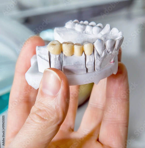 Obraz Technical shots of model on a dental prothetic laboratory
