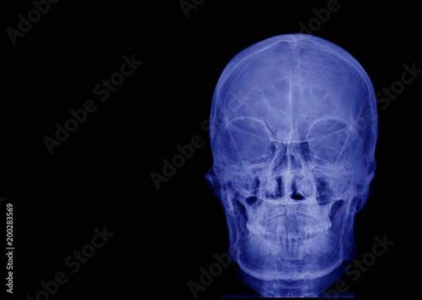 Fototapeta X-ray image of front view asian skull and blank area at left side