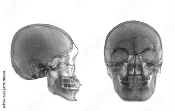 Fototapeta Very good quality X-ray image of normal human skull front (AP) view and side (Lateral) view, Invert from normal tone, isolated on white background.