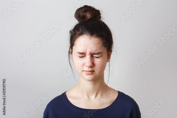 Obraz portrait of a pimply teenage girl in a blue T-shirt on a gray background,  with eyes closed