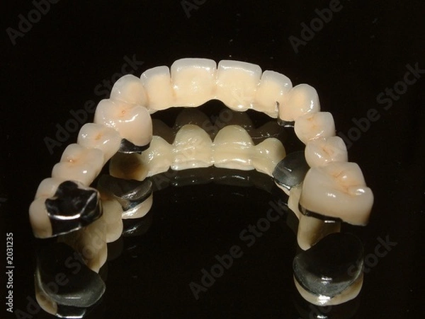 Obraz proteza dentystyczna
