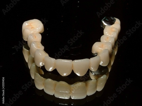Obraz dental denture