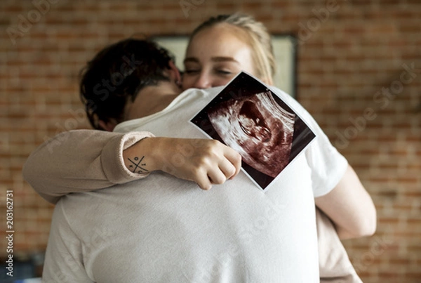 Fototapeta Biała para ze zdjęciem USG dziecka