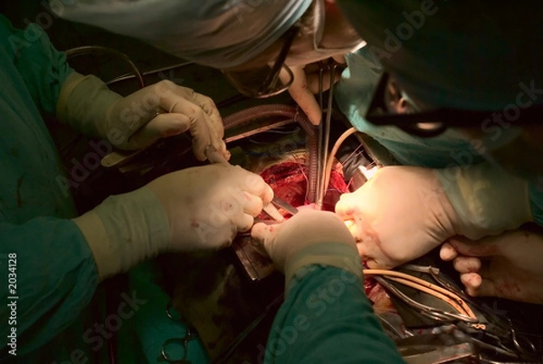 Fototapeta surgeons at work