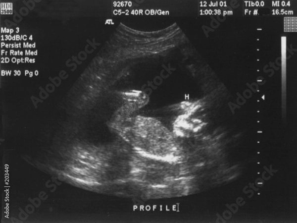 Fototapeta Ultradźwięki dla dzieci