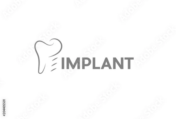 Obraz Implant logo
