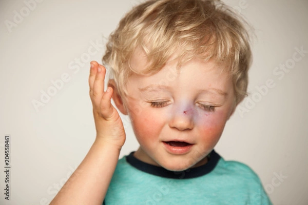 Fototapeta Kopfschmerzen