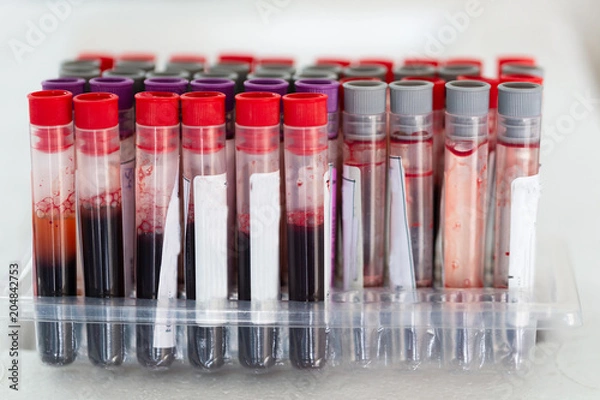 Obraz Blood collection tubes