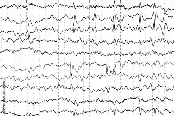 Fototapeta Abnormal EEG  brain wave