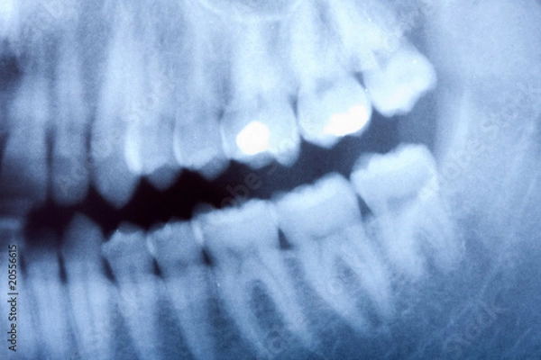 Fototapeta Dental rentgen