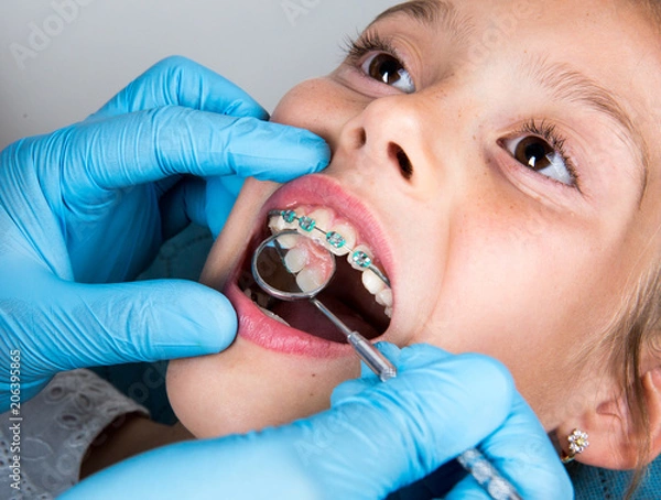 Obraz Dentist, Orthodontist examining a little girl patient's teeth
