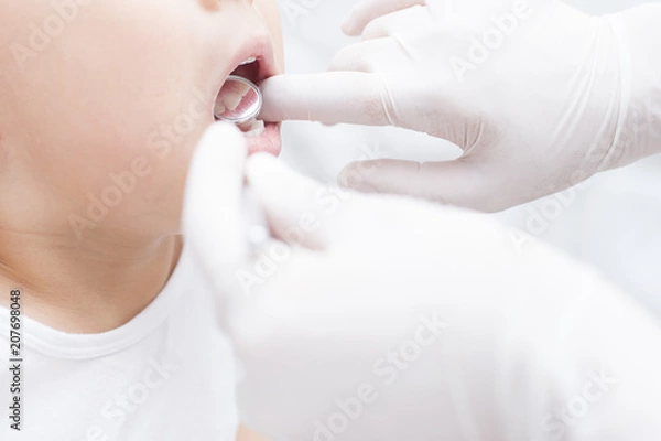 Obraz 歯のチェック