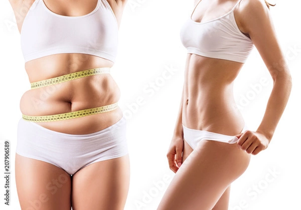 Obraz Woman's body before and after weight loss.