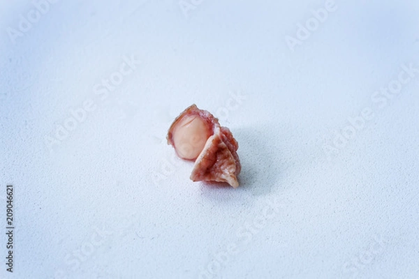 Fototapeta Fibroma, mole close-up in a cut on a white background