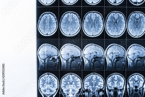 Obraz MRI of the head and brain