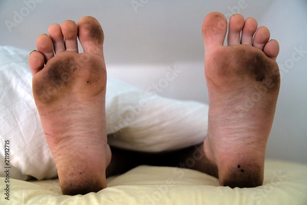 Fototapeta Dirty bare feet of a sleeping person showing out of the blanket on a bed