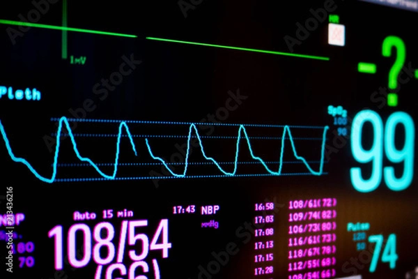 Fototapeta Normal heart function on pulse oximeter pleth graph bar