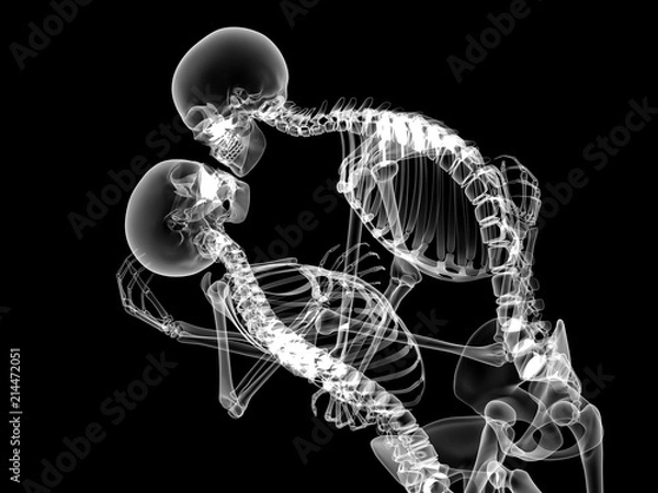 Obraz X RAY Skeleton Couple in love 3D Render