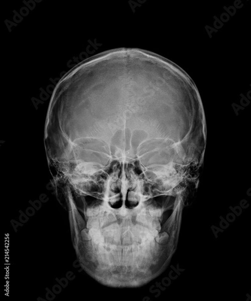 Obraz head skull x-ray front view