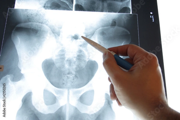 Fototapeta img_2240radios