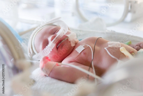 Obraz premature newborn baby in incubator