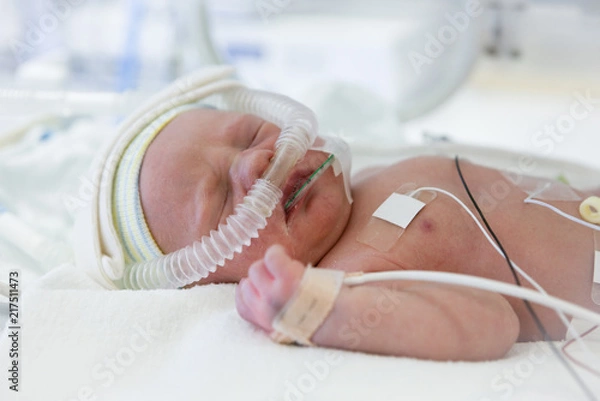 Obraz premature newborn baby in incubator