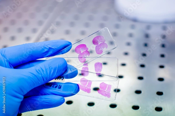 Fototapeta Hand in blue glove with histological rat liver, kidney an spleen tissue samples