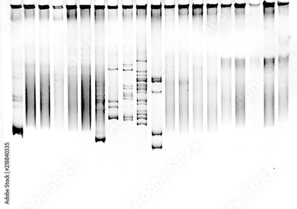 Obraz Mutation screening in polyacrylamide gel