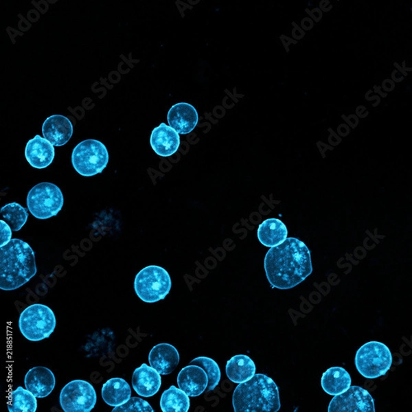 Obraz Human acute leukemia cell line